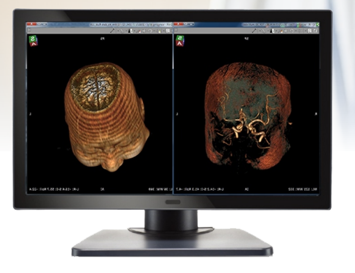 32寸8M醫(yī)療顯示器（S3201）
